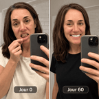Dentifrice blanchissant à la niacinamide - TriBright