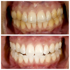 Dentifrice blanchissant à la niacinamide - TriBright